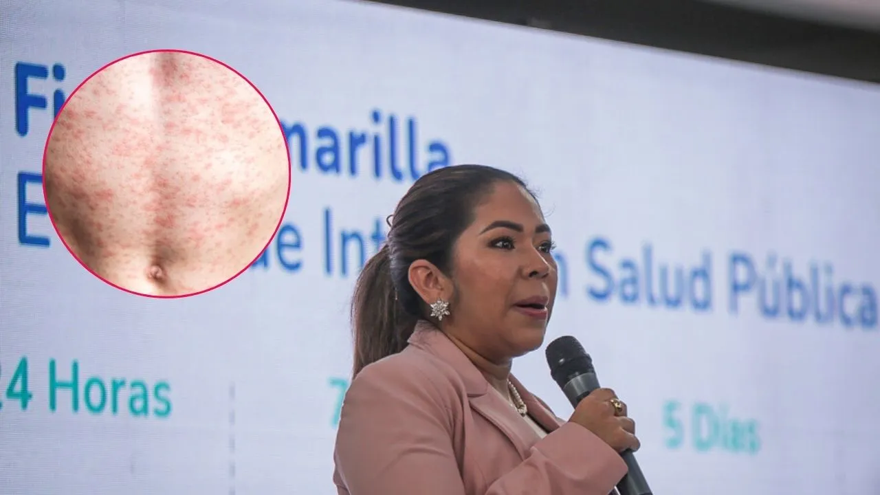 ¿Qué tan inmunizado está Colombia del sarampión? La OPS acaba de reportar el estatus que tiene el país