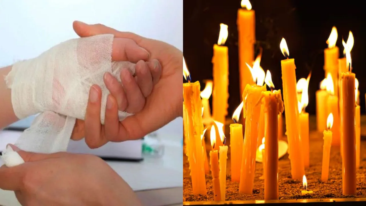 Día de Velitas 2025: ¿Cuántos quemados por pólvora reporta el país?