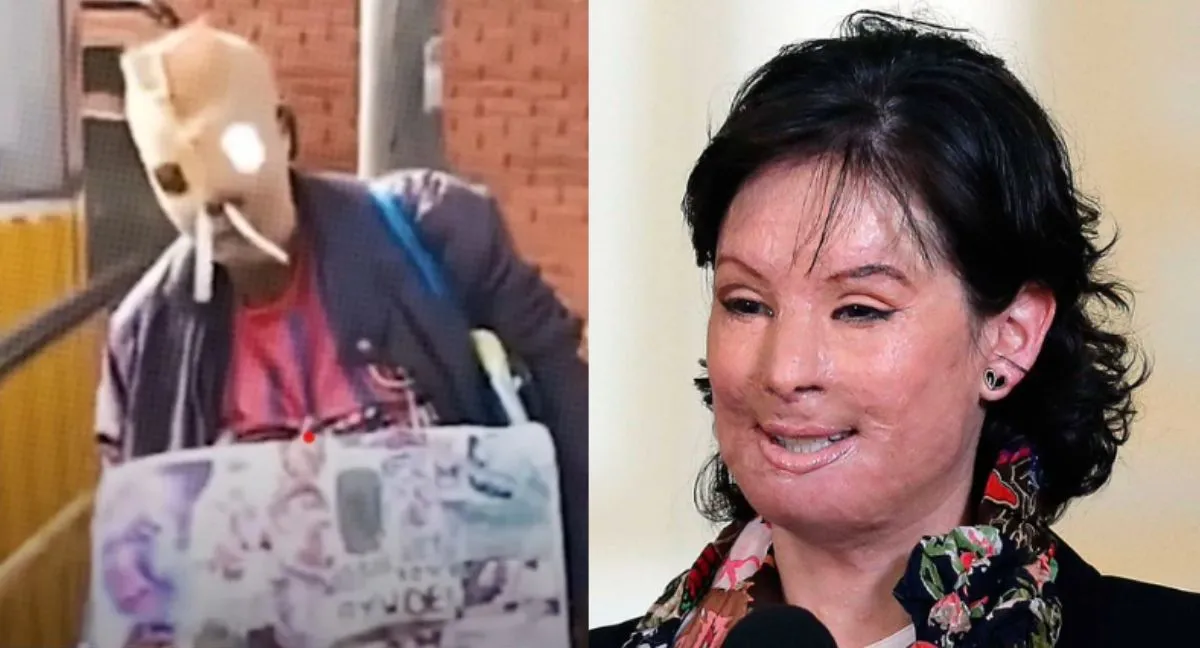 María Consuelo Córdoba y más víctimas de ataques con ácido en Colombia. De María Consuelo Córdoba a Natalia Ponce: víctimas de ataques con ácido que marcaron a Colombia